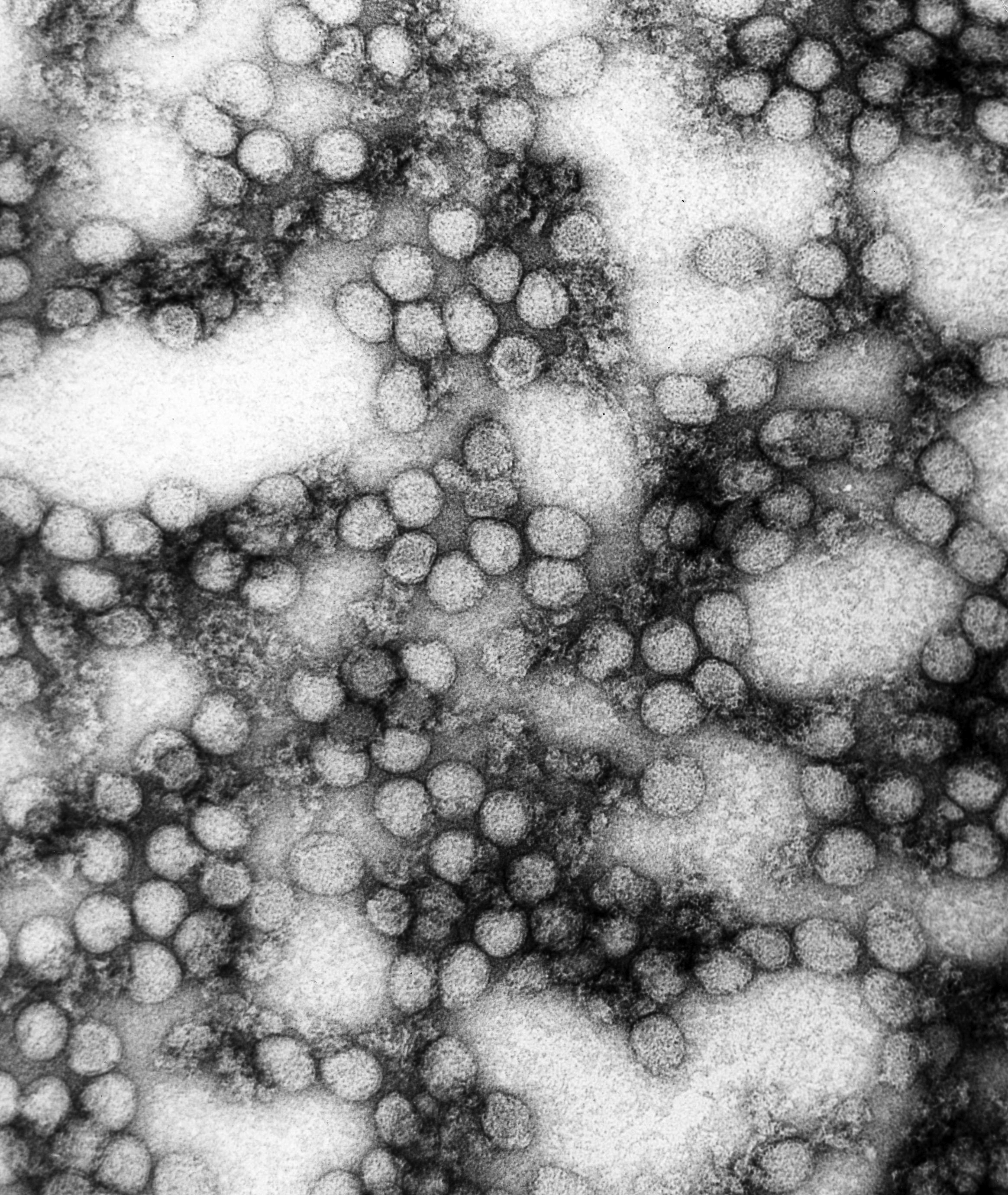 Electron microscope image of yellow fever virus particles